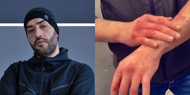 Brulux se bagarre avec trois personnes, il s\'affiche les mains en sang (vidéo)