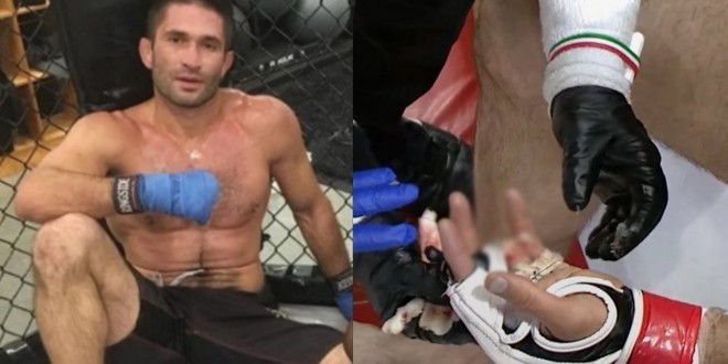 Un combattant perd son doigt en plein combat de MMA avant de le retrouver (vidéo) 
