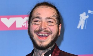 Post Malone s’offre un sourire à 1.6 millions de dollars (Photos) Post Malone s’offre un sourire à 1.6 millions de dollars (Photos)