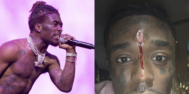 Lil Uzi Vert s\'est fait arracher son diamant implanté sur le front en plein concert 