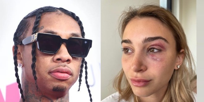 Tyga arrêté pour violences physiques sur son ex petite amie 