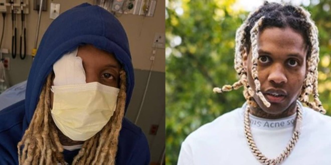 Lil Durk blessé par des produits pyrotechniques lors d’un concert à Chicago (Vidéo) 