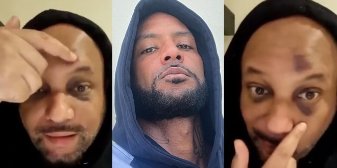 Matt Houston montre son visage complètement amoché, Booba réagit (vidéo)