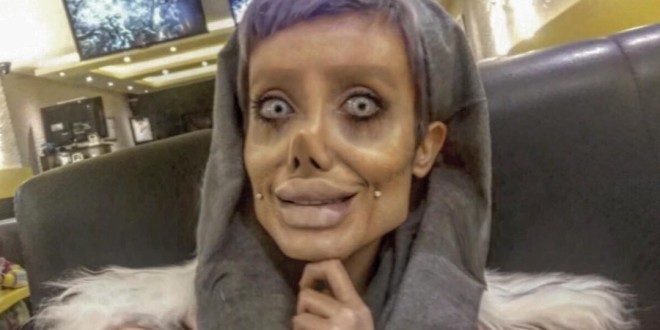 Une jeune femme subi 50 opérations pour ressembler à Angelina Jolie!