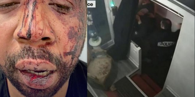 Un producteur victime d\'un violent tabassage par plusieurs policiers à Paris 