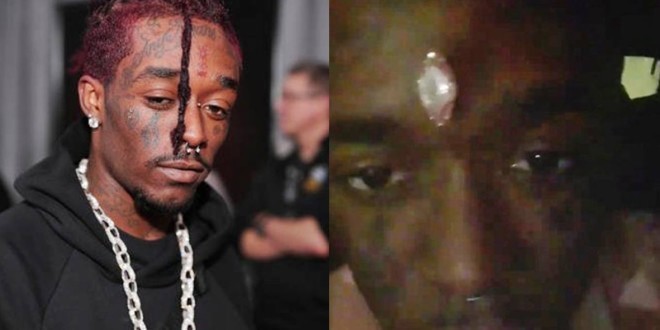 Lil Uzi Vert s\'est fait implanter son diamant sur le front parce qu\'il avait peur de le perdre