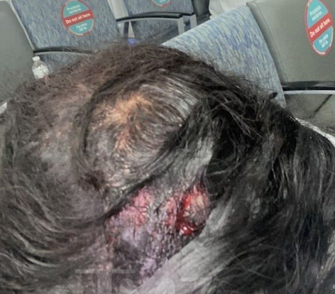 6ix9ine dérape et blesse une strip-teaseuse ? Elle dévoile des photos de ses blessures